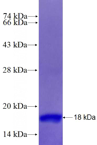 Recombinant Human TUSC2 SDS-PAGE