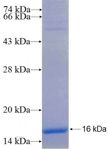 Recombinant Human ARRDC1 SDS-PAGE