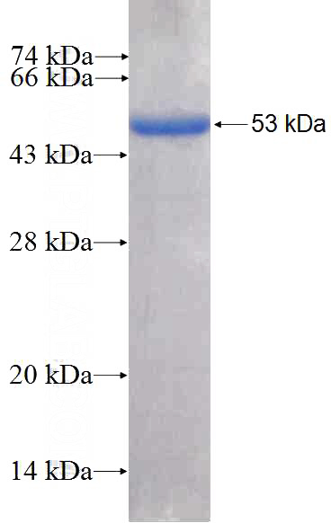 Recombinant Human BACH2 SDS-PAGE