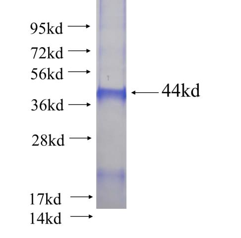 Recombinant human ZNF671 SDS-PAGE