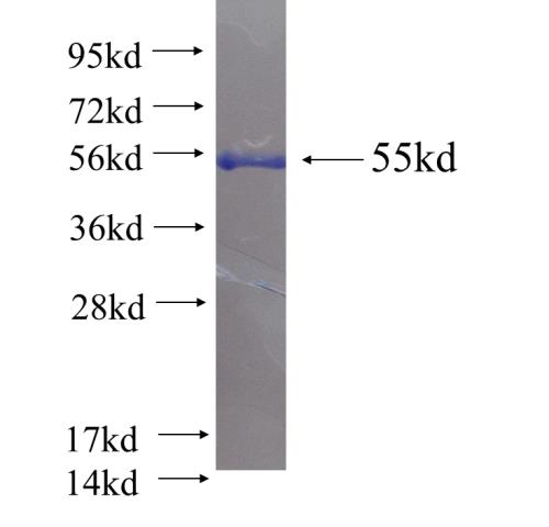 Recombinant human PGAM1(Full length) SDS-PAGE