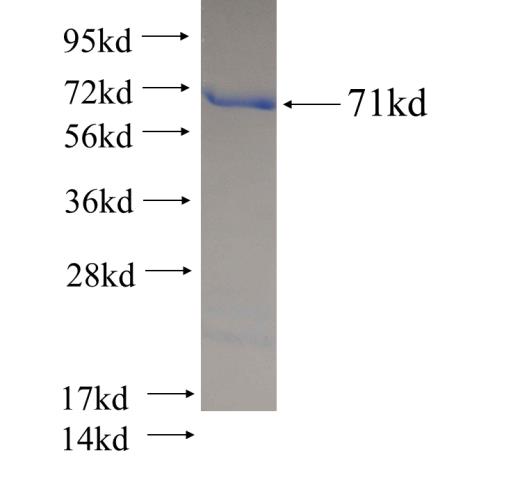 Recombinant human HADHA SDS-PAGE