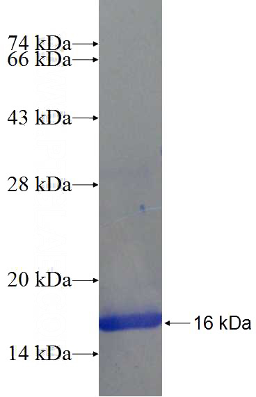 Recombinant Human SRMS SDS-PAGE