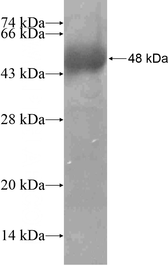 Recombinant Human ALOX5 SDS-PAGE