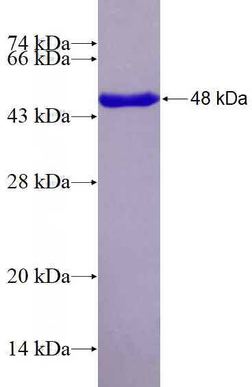 Recombinant Human SMC1A SDS-PAGE