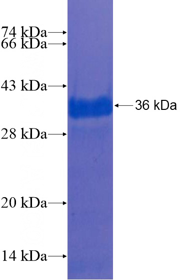 Recombinant Human ZKSCAN2 SDS-PAGE