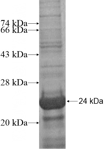 Recombinant Human TBC1D10A SDS-PAGE