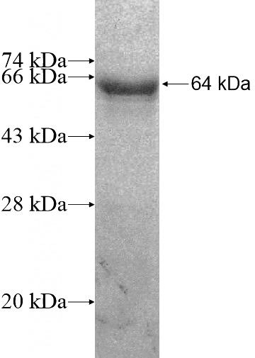 Recombinant Human RIC8B SDS-PAGE
