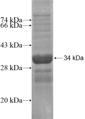 Recombinant Human BZW2 SDS-PAGE