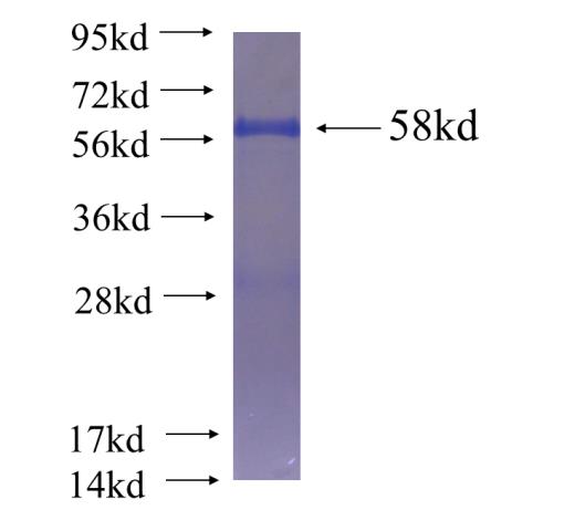 Recombinant human ZBTB44 SDS-PAGE