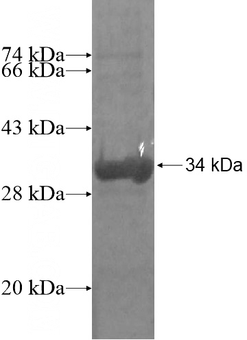 Recombinant Human HDHD3 SDS-PAGE