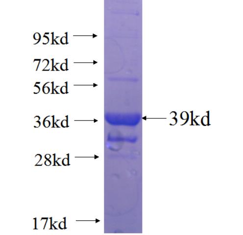Recombinant human CENPP SDS-PAGE