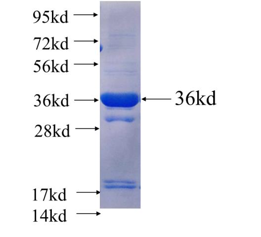 Recombinant human MLN64,STARD3 SDS-PAGE