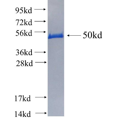 Recombinant human RAB2B(Full length) SDS-PAGE