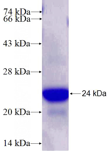Recombinant Human ATXN7 SDS-PAGE