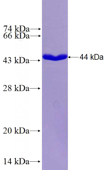 Recombinant Human RNF139 SDS-PAGE