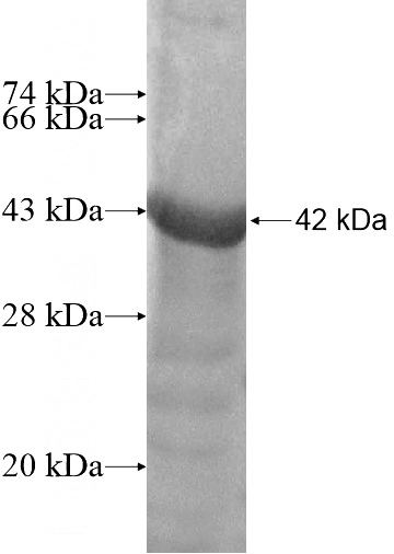 Recombinant Human ZNF213 SDS-PAGE