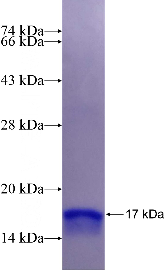 Recombinant Human RFC5 SDS-PAGE