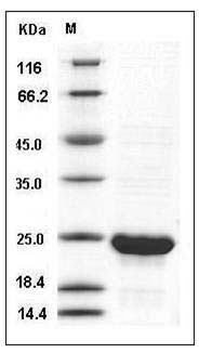 Rat CNTF / Ciliary Neurotrophic Factor Protein SDS-PAGE
