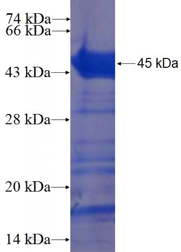Recombinant Human ANKS6 SDS-PAGE
