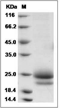 Cynomolgus CTLA4 / CD152 Protein (His Tag) SDS-PAGE