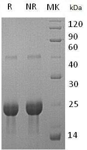 Mouse Tnfrsf1a/Tnfr-1/Tnfr1 recombinant protein