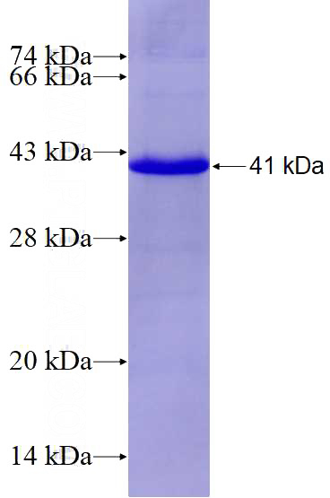 Recombinant Human HAS1 SDS-PAGE
