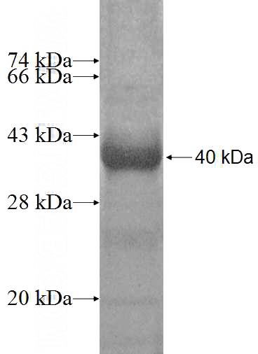 Recombinant Human IQSEC1 SDS-PAGE