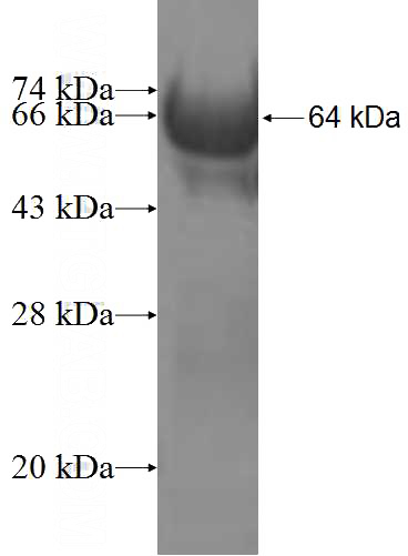 Recombinant Human DUSP12 SDS-PAGE