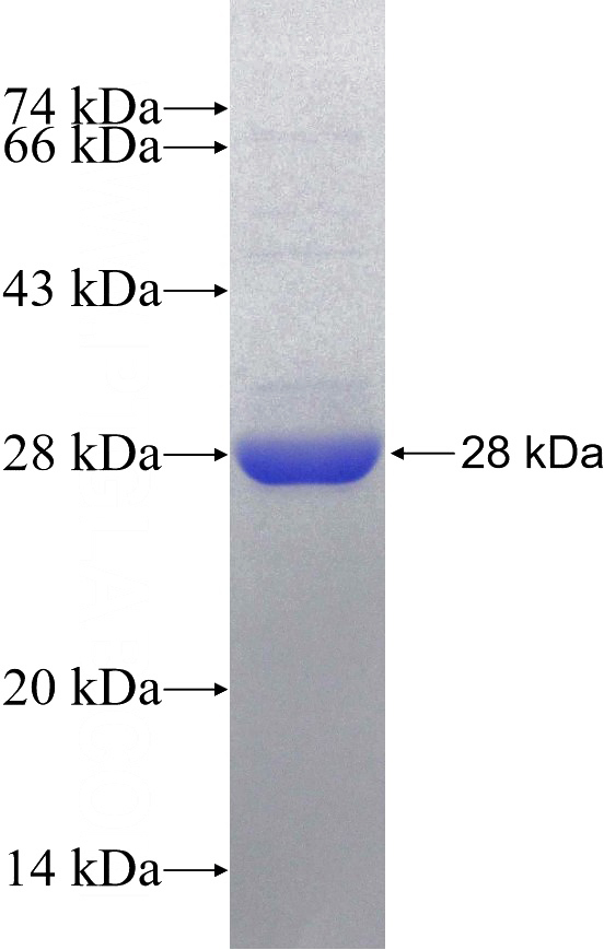 Recombinant Human PSMB9 SDS-PAGE