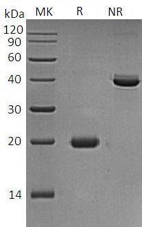 Human IL17D/UNQ3096/PRO21175 recombinant protein