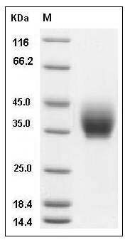 Mouse ICOS / AILIM / CD278 Protein (Fc Tag) SDS-PAGE