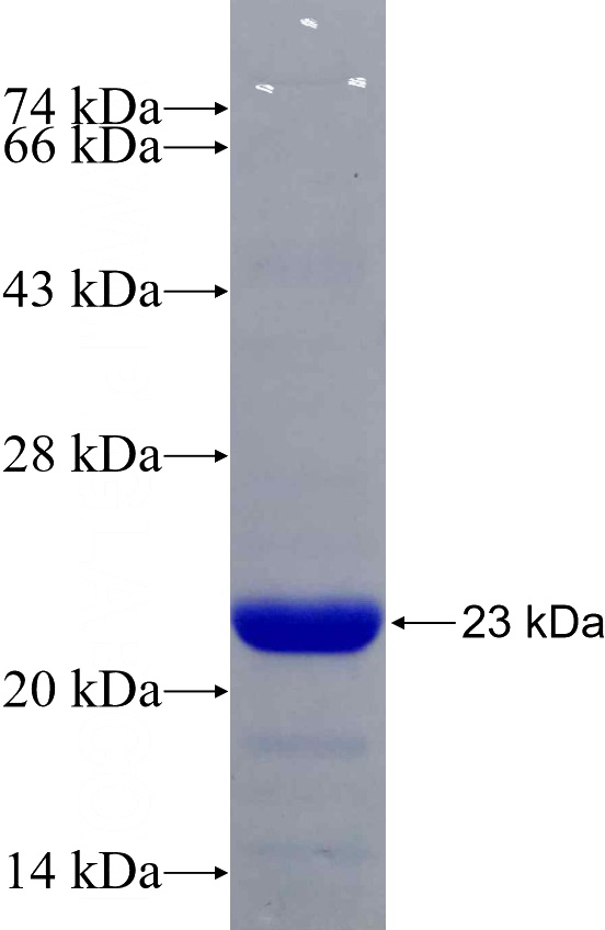 Recombinant Human MAP1LC3C SDS-PAGE