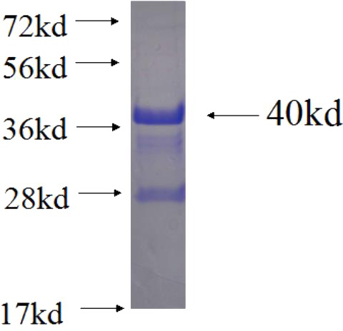 Recombinant Human MAN1C1 SDS-PAGE