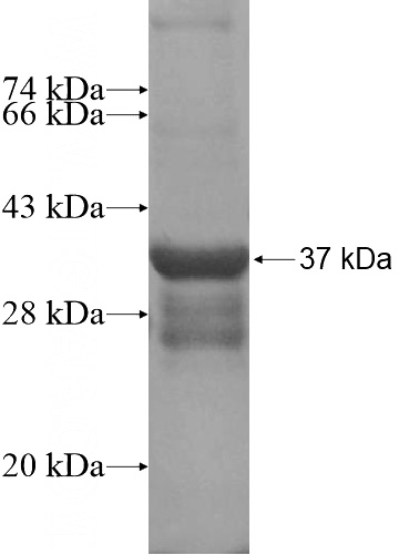 Recombinant Human USP36 SDS-PAGE