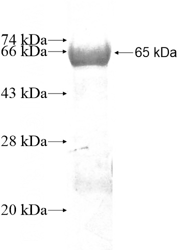 Recombinant Human PCDHB11 SDS-PAGE