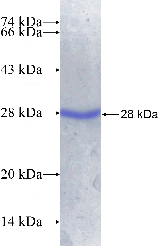 Recombinant Human FBXO18 SDS-PAGE