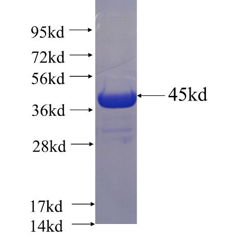 Recombinant human SKP1 SDS-PAGE