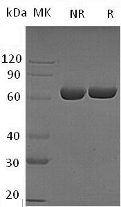 Human LTA4H/LTA4 (His tag) recombinant protein