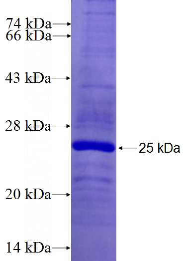 Recombinant Human TGM7 SDS-PAGE