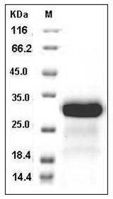 Human CCL8 / MCP-2 Protein (SUMO Tag) SDS-PAGE