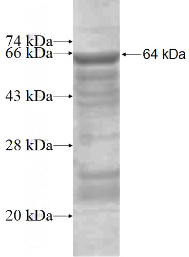 Recombinant Human DHH SDS-PAGE