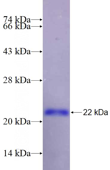 Recombinant Human NDUFB9 SDS-PAGE