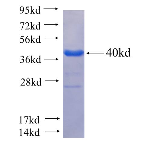 Recombinant human DPPA4(Full length) SDS-PAGE