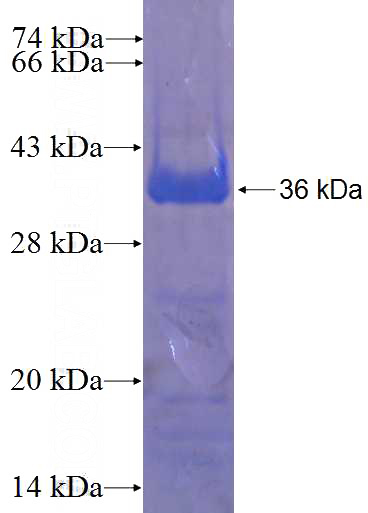 Recombinant Human ZNF394 SDS-PAGE