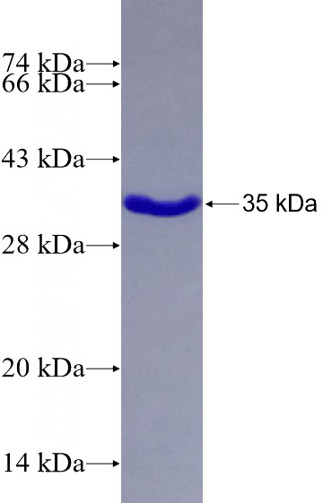 Recombinant Human PSRC1 SDS-PAGE