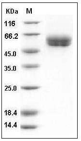 Human IL1R1 / CD121a Protein (His Tag) SDS-PAGE