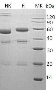 Human CPE (His tag) recombinant protein