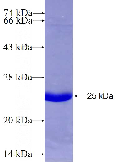 Recombinant Human KLHL13 SDS-PAGE