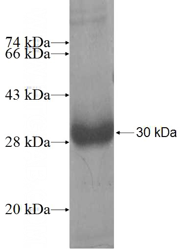 Recombinant Human MREG SDS-PAGE